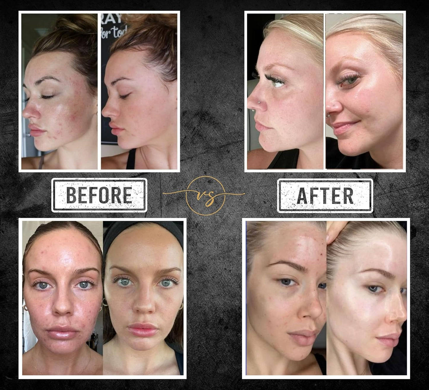 All-in-One Face & Body Unisex Bar - 40+ Ingredient Complex Vitamin C,E,B3 Retinol, Hyaluronic/Glycolic/Salicylic Acid - Kojic, Turmeric and B-Carotene for Cleansing and Beautifying Skin (10.6 oz)-FemmiqueWomen