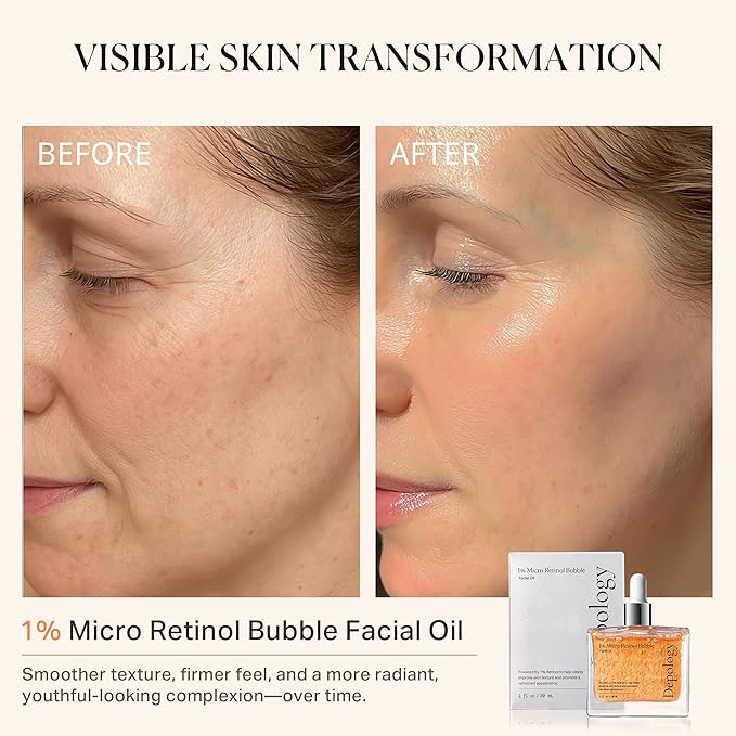 1% Retinol Face Oil with Firming, Smoothing & Glowing– Retinol Serum for Face, Lightweight Squalane Facial Oil for Fine Lines, Texture & Anti-Aging, Gentle for All Skin 1.01 fl oz-FemmiqueWomen