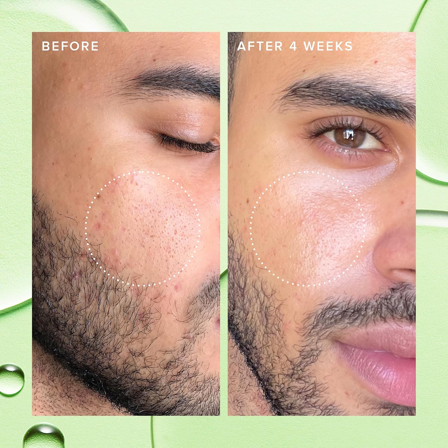 Farmacy 2% Salicylic Acid Toner for Face - Deep Sweep Gentle BHA Exfoliant for Oily Skin - Refines Texture with Papaya Enzymes & Moringa Water for a Healthy-Looking Complexion (10ml)-FemmiqueWomen