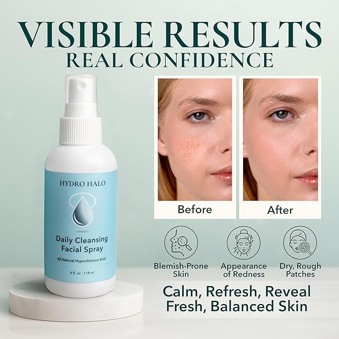 Hypochlorous Acid Spray for Face 4oz – Pure Hypochlorous Acid Spray Cleaner, Daily Cleansing Facial, pH Balanced, Plant Based, No Alcohol, USA Made-FemmiqueWomen