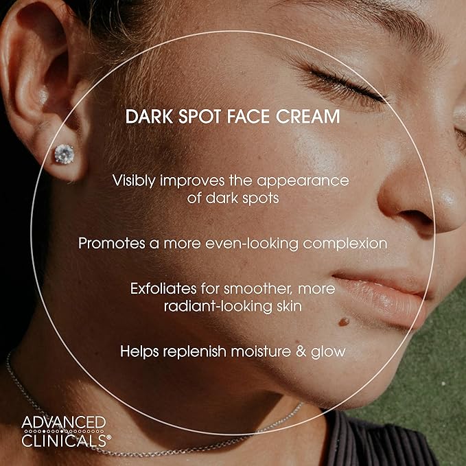 Advanced Clinicals Dark Spot Face Moisturizer | Lactic Acid Lotion For Face With Caffeine, Cocoa Butter, & Vitamin A | Brightening Cream Visibly Reduces Look Of Dark Spots & Uneven Skin Tone, 2 Fl Oz-FemmiqueWomen