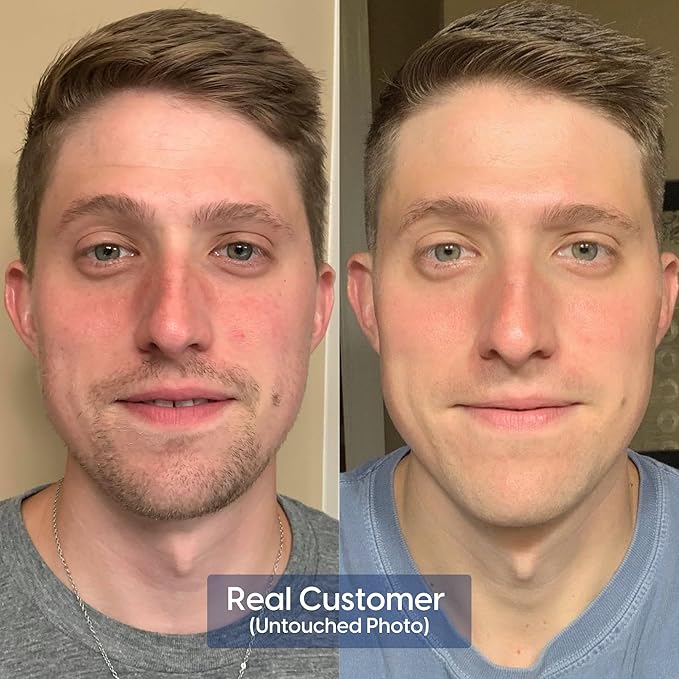 Strive Hydrating Men's Face Wash - Deep Cleans Pores, Exfoliates & Brightens - Refreshing Aloe Vera, Hyaluronic Acid & Niacinamide - Fragrance Free Men's Skincare - 200ml-FemmiqueWomen