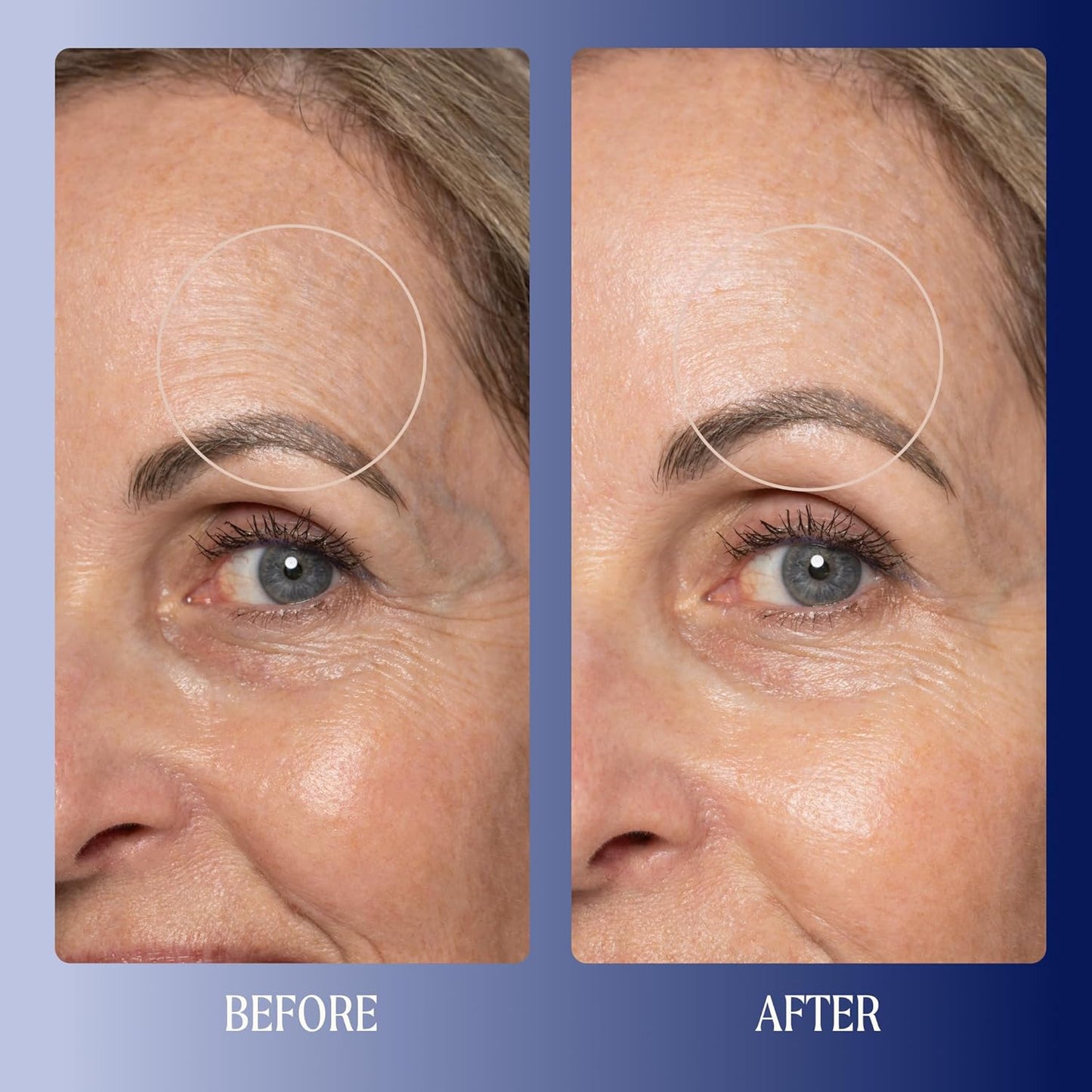 Kinship Super Rich Collagen + Ceramide Firming Cream | Anti Aging, Hydrating Face Moisturizer for Sensitive Skin | Wrinkle Cream - Smooth Fine Lines | Synthetic Fragrance-Free | Derm Approved, (1.7oz)-FemmiqueWomen