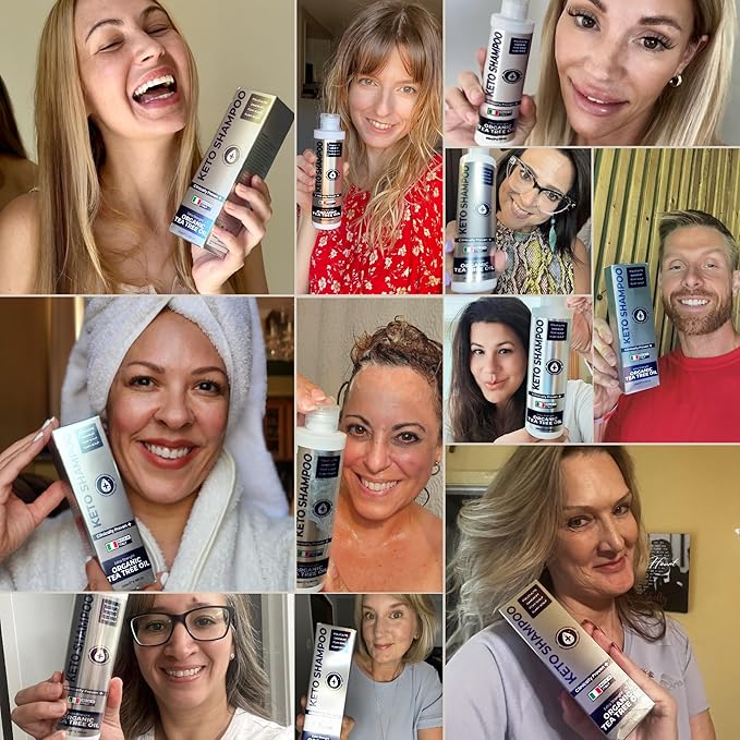 Scalp Psoriasis Shampoo, Flakes Shampoo Anti Dandruff, Itchy Scalp Treatment for Seborrheic Dermatitis & Folliculitis, Anti Fungal, Medicated Solution for Itchy, Flaky & Dry Hairs-FemmiqueWomen