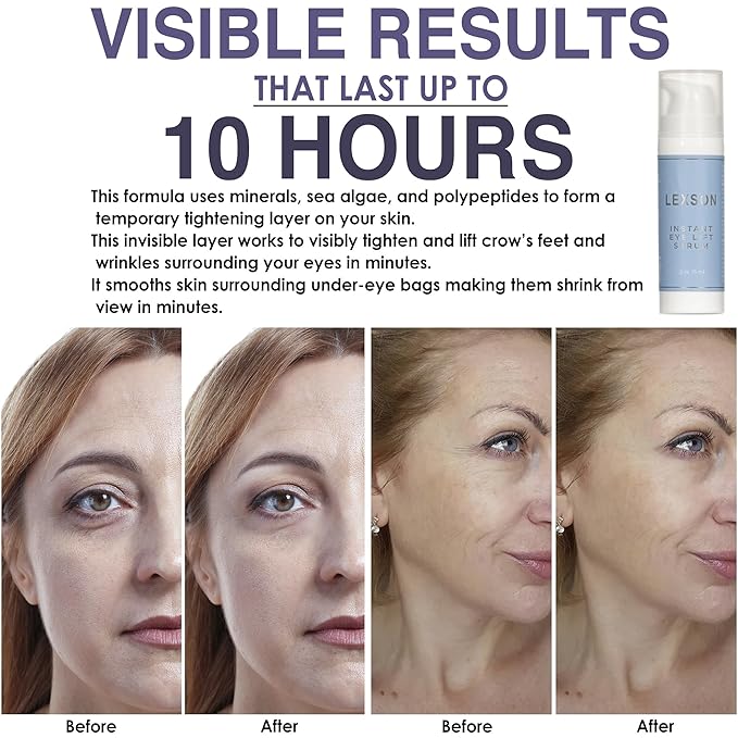 Instant Eye Lift Serum - Provides Immediate Visible Results, Lifts Away Appearance of Lines & Wrinkles. Dark Circles Under Eye Treatment, Eye Cream for Dark Circles and Puffiness-FemmiqueWomen