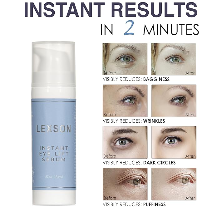 Instant Eye Lift Serum - Provides Immediate Visible Results, Lifts Away Appearance of Lines & Wrinkles. Dark Circles Under Eye Treatment, Eye Cream for Dark Circles and Puffiness-FemmiqueWomen