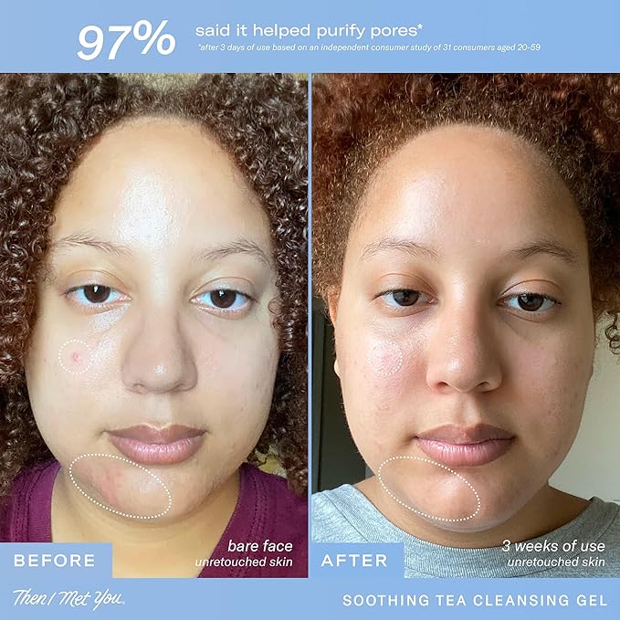 Then I Met You Soothing Tea Cleansing Gel, Hydrating Water-Based Face Cleanser with Fermented Rice Water & Green Tea, Vegan & Clean Skincare, 3.38 oz-FemmiqueWomen