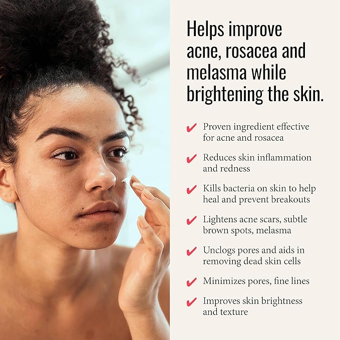 Azelaic Acid 14% Cream - Helps Calm Acne & Rosacea, Reduces Inflammation & Minimizes Pores - 1 Fl Oz-FemmiqueWomen