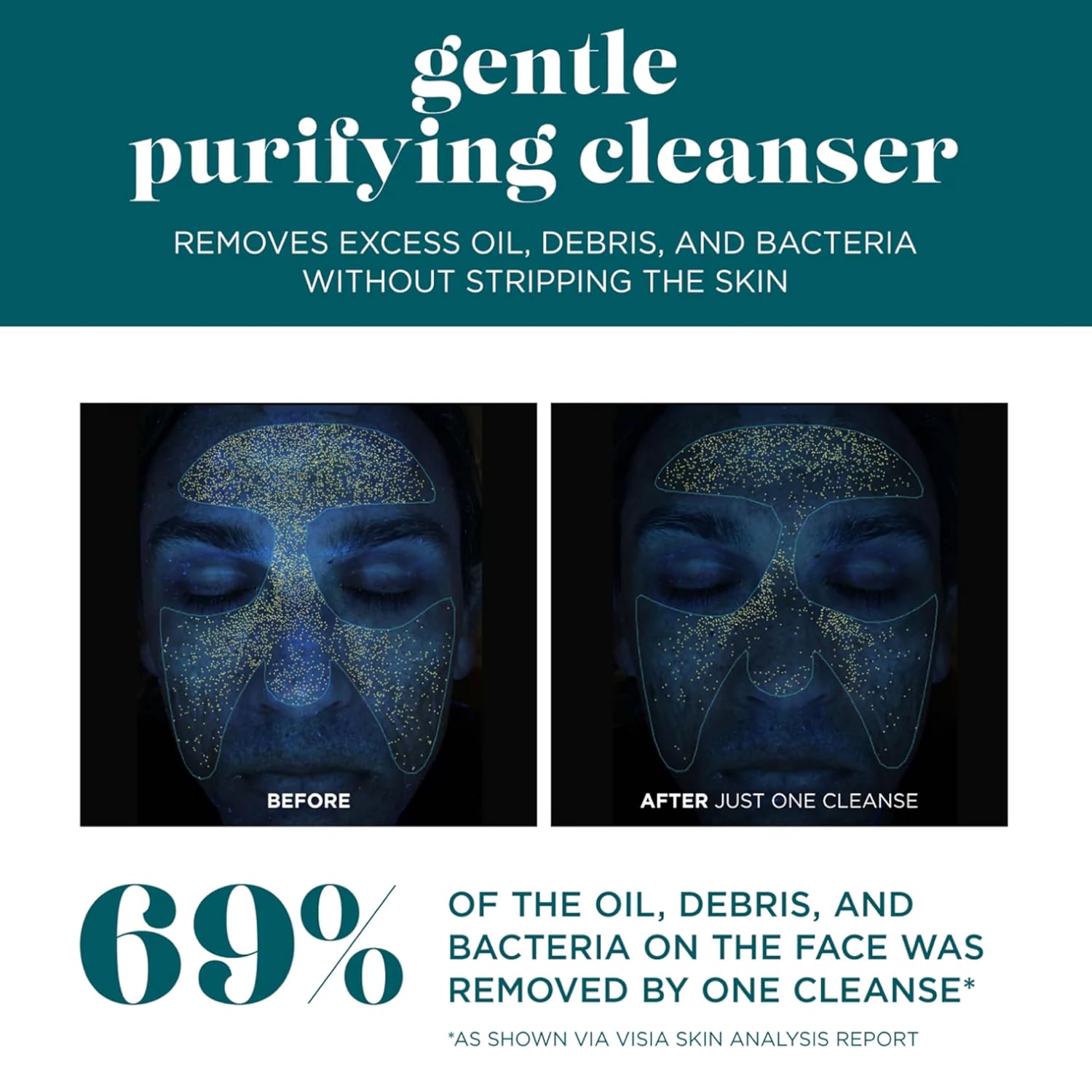 VI DERM Gentle Purifying Cleanser – Hydrating Water-Based Face Wash for Women & Men – Gentle Moisturizing Facial Cleanser with Aloe Vera, Vitamin E & Willow Bark Extract – Fragrance Free, 4 Fl Oz-FemmiqueWomen