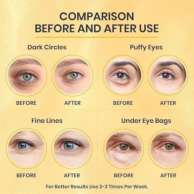 24k Gold Under Eye Patches for Puffy Eyes (7 Pairs) – Gold Foil Under Eye Masks for Dark Circle with Betaine, Hyaluronic Acid – Skincare Eye Bags Patches Treatment for Men & Women-FemmiqueWomen