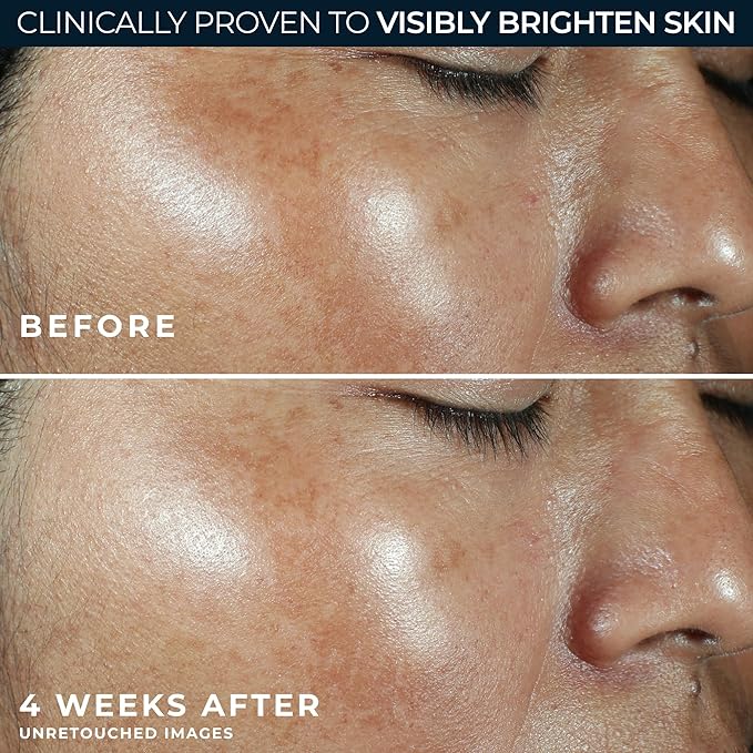 RoC Multi Correxion Revive + Glow Vitamin C Sunscreen Broad Spectrum SPF 30 Face Moisturizer (1.7 oz) with Retinol Eye Cream Packette-FemmiqueWomen