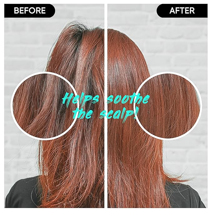 Centella Shampoo Bar 2.0 - Hydrating & Moisturizing Natural Hair Soap Bar Shampoo for Hair & Scalp Nourishment - Bathing Soap Solid Shampoo for All Hair Types (120g, 4.23oz)-FemmiqueWomen