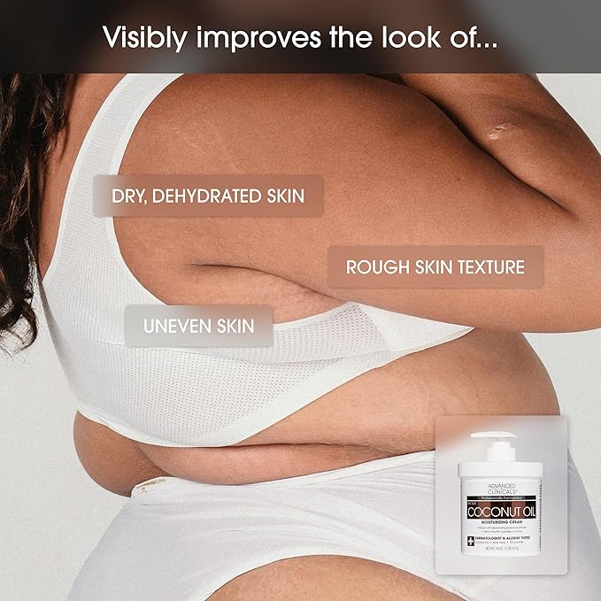 Advanced Clinicals Coconut Oil Body Cream For Women & Men | Hydrating Coconut Lotion For Extremely Dry Skin | Visible Anti Aging Body Butter Skin Care Balm Moisturizer For Hand, Heel, Feet, 16oz, 2PC-FemmiqueWomen