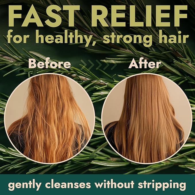 Rosemary Shampoo and Conditioner Set Infused with Tea Tree & Rosemary Oils for Scalp Relief and Hair Growth | Sulfate Free, Soothes Dry Scalp, Boosts Shine + Free Scalp Brush | 16.9 fl oz-FemmiqueWomen
