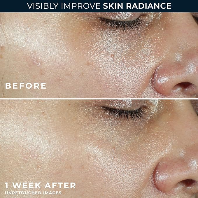 RoC Multi Correxion Revive + Glow Vitamin C Sunscreen Broad Spectrum SPF 30 Face Moisturizer (1.7 oz) with Retinol Eye Cream Packette-FemmiqueWomen