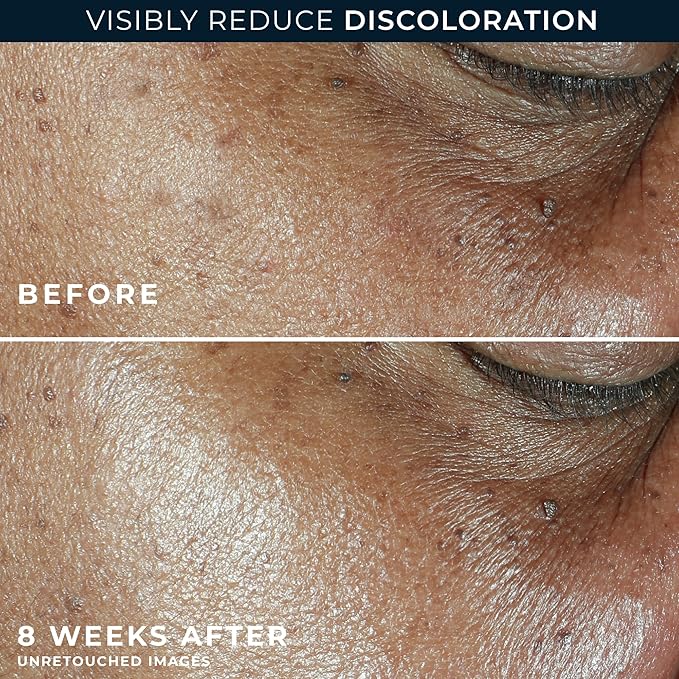 RoC Multi Correxion 5 in 1 Anti-Aging Daily Facial Moisturizer for Women and Men, Broad Spectrum SPF 30 & Shea Butter (1.7 oz) with Night Cream Packette (Packaging May Vary)-FemmiqueWomen