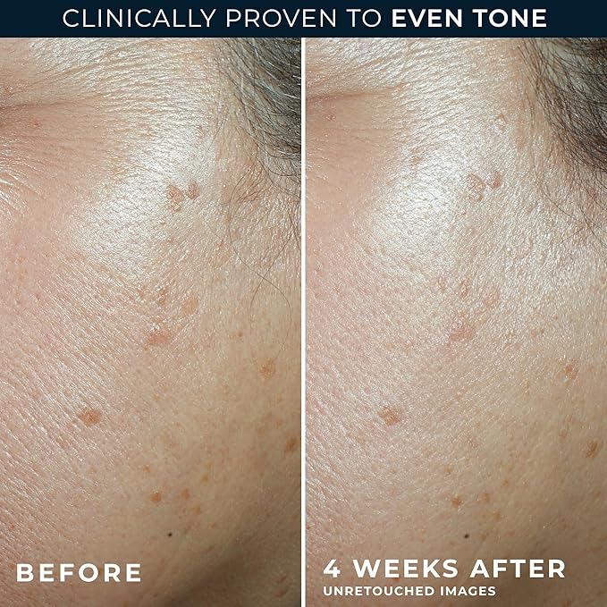 RoC Multi Correxion 5 in 1 Anti-Aging Daily Facial Moisturizer for Women and Men, Broad Spectrum SPF 30 & Shea Butter (1.7 oz) with Night Cream Packette (Packaging May Vary)-FemmiqueWomen