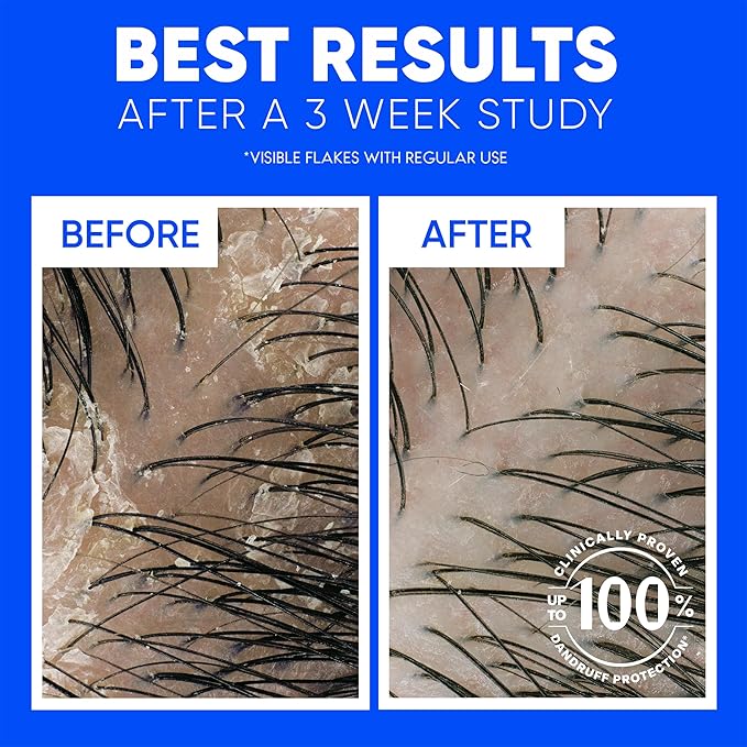 Head & Shoulders Classic Clean Dandruff Shampoo Twin Pack, Anti-Dandruff Daily Use, Paraben-Free, Color-Safe, 32.1 Fl Oz Each (Set of 2)-FemmiqueWomen