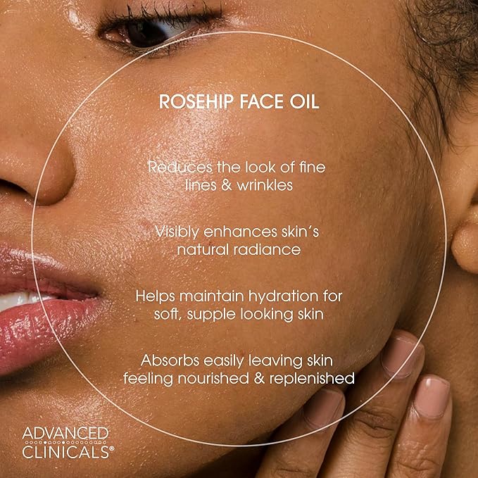 Advanced Clinicals Rosehip Oil For Face With Vitamin E + Botanicals Helps Improve Look Of Dark Spots, Wrinkles, Fine Lines, & Uneven Looking Skin Tone | Moisturizing Skin Care Face Serum, 1.8 Fl Oz-FemmiqueWomen