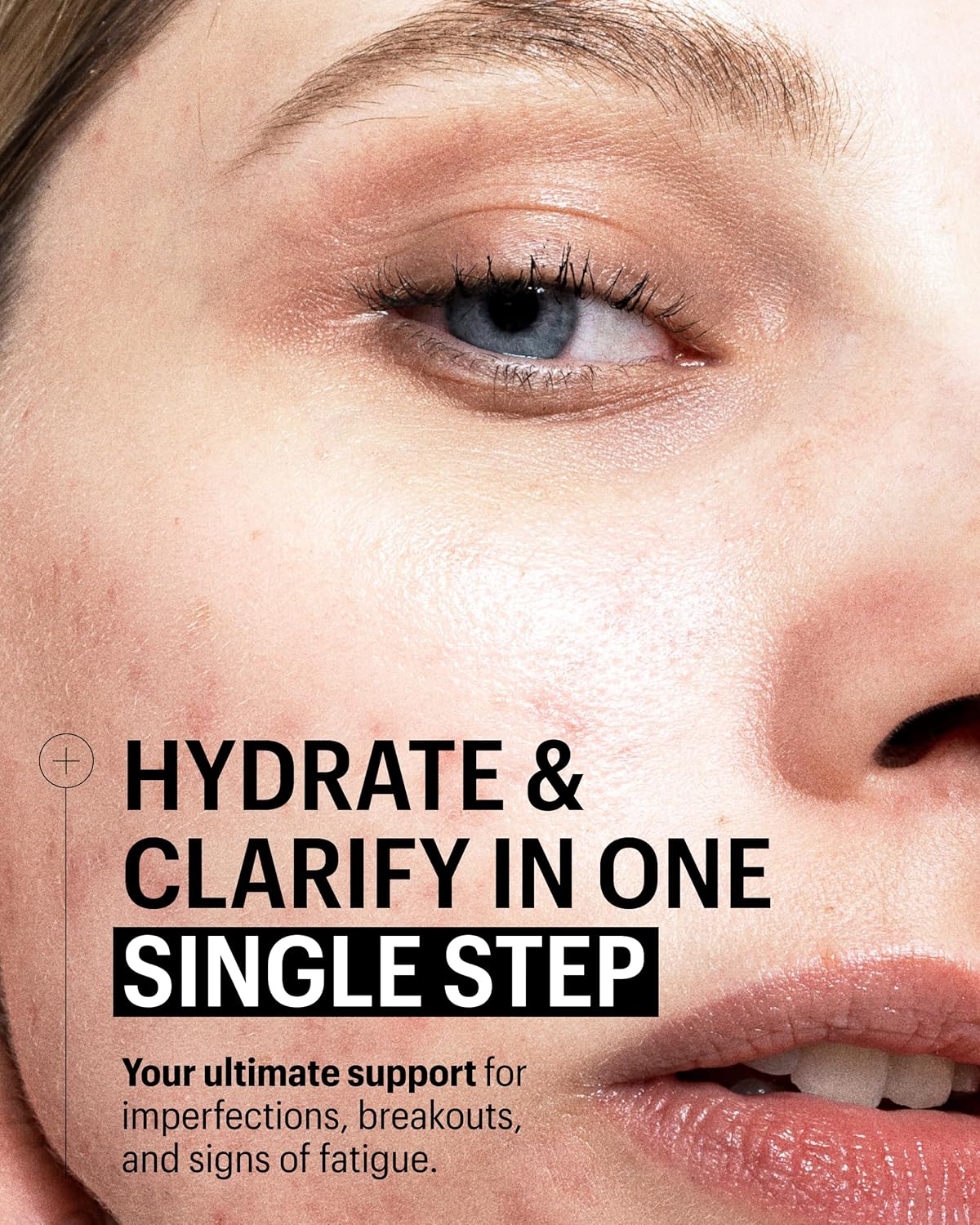 Allies of Skin Multi Nutrient & Dioic Renewing Cream: Moisturizer with Dioic Acid, 14 Antioxidants, Probiotics & Centella Asiatica. Targets Imperfections, Brightens & Protects Skin 1.7 oz / 50 ml-FemmiqueWomen