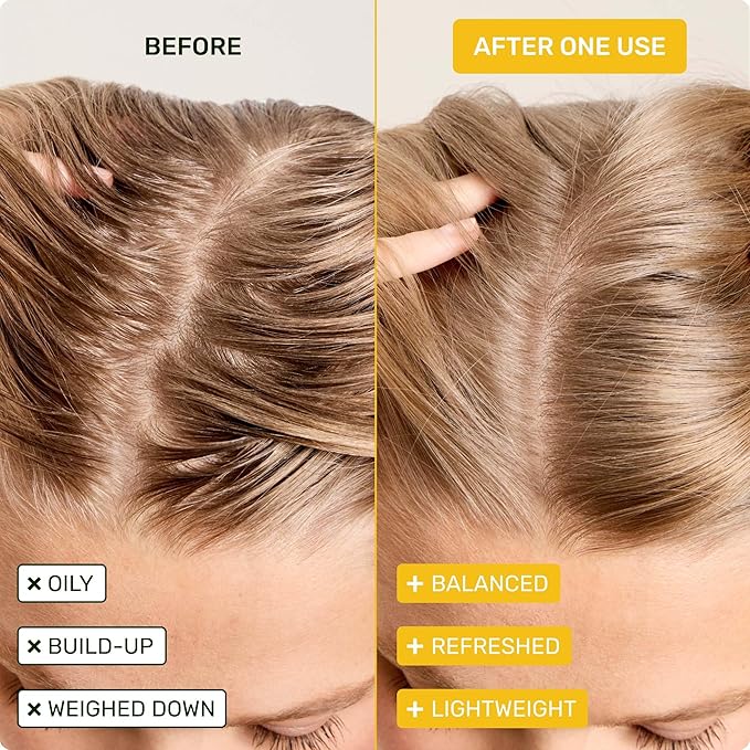 Ethique Clarifying Shampoo Bar for oily hair with Castor Oil - Plastic-Free, Vegan, Cruelty-Free, 3.88 oz - Formerly St. Clements-FemmiqueWomen